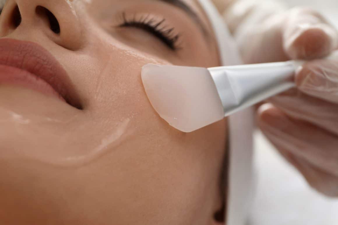 How Chemical Peels Rejuvenate Pigmentation and Treat Acne